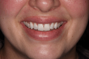 patient 10 before
