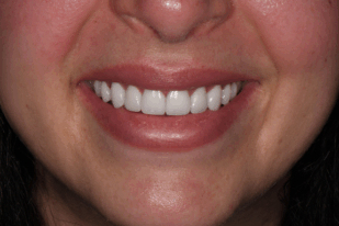 patient 10 after