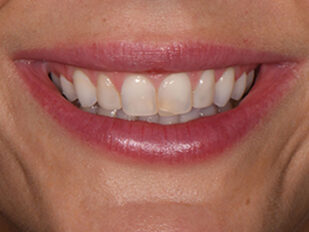 patient 10 before