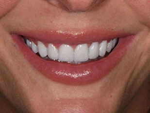 patient 10 after