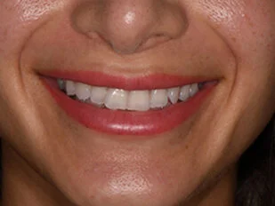 patient 11 before