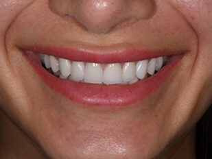 patient 11 after