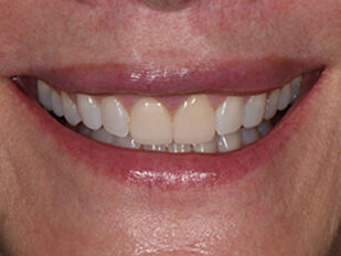patient 12 before