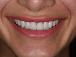 patient 12 after