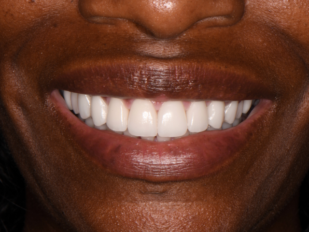 patient 14 after
